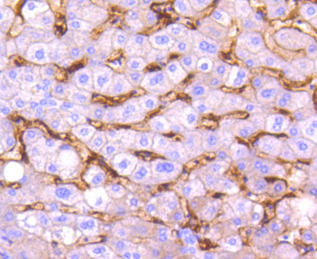 CD14 Antibody in Immunohistochemistry (Paraffin) (IHC (P))