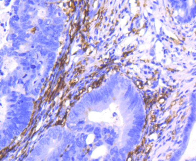 CD14 Antibody in Immunohistochemistry (Paraffin) (IHC (P))