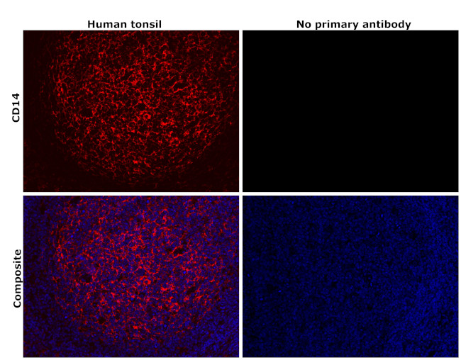 CD14 Antibody in Immunohistochemistry (Paraffin) (IHC (P))