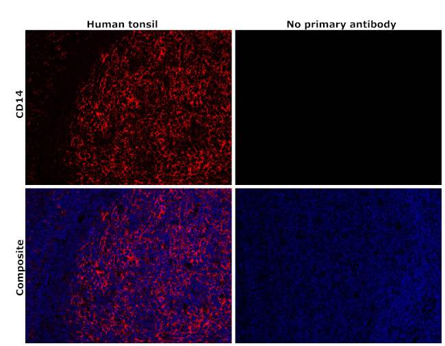 CD14 Antibody in Immunohistochemistry (Paraffin) (IHC (P))