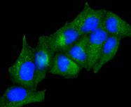 Adiponectin Receptor 1 Antibody in Immunocytochemistry (ICC/IF)