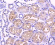 Adiponectin Receptor 1 Antibody in Immunohistochemistry (Paraffin) (IHC (P))