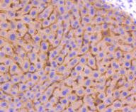 Adiponectin Receptor 1 Antibody in Immunohistochemistry (Paraffin) (IHC (P))