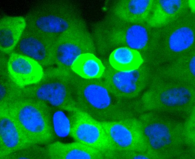 Cortactin Antibody in Immunocytochemistry (ICC/IF)