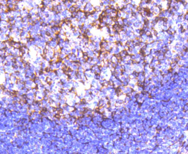 Cortactin Antibody in Immunohistochemistry (Paraffin) (IHC (P))