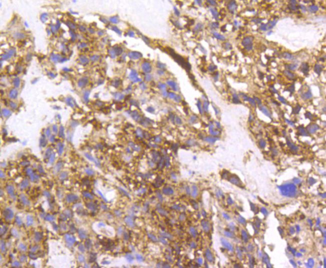 Cortactin Antibody in Immunohistochemistry (Paraffin) (IHC (P))