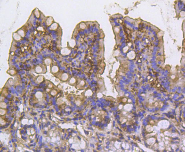 Cortactin Antibody in Immunohistochemistry (Paraffin) (IHC (P))