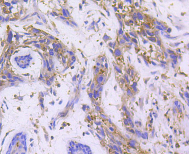 RALBP1 Antibody in Immunohistochemistry (Paraffin) (IHC (P))