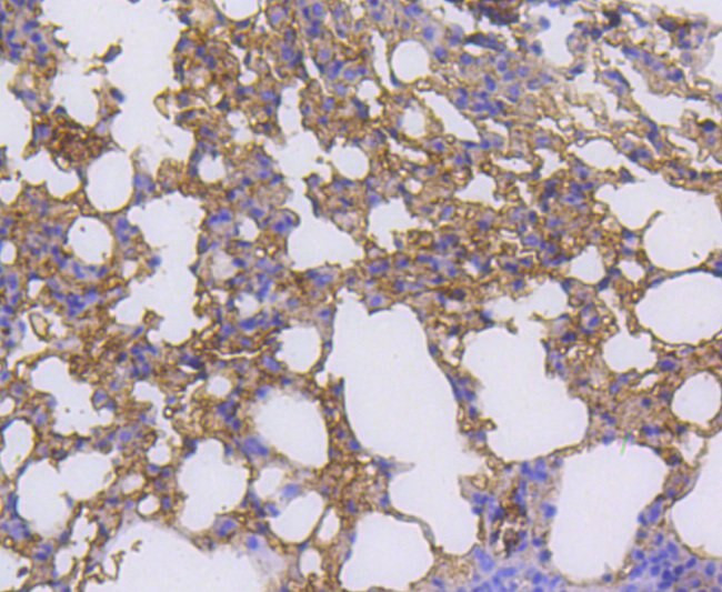 RALBP1 Antibody in Immunohistochemistry (Paraffin) (IHC (P))