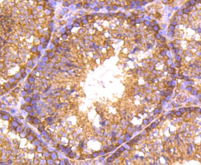 RALBP1 Antibody in Immunohistochemistry (Paraffin) (IHC (P))