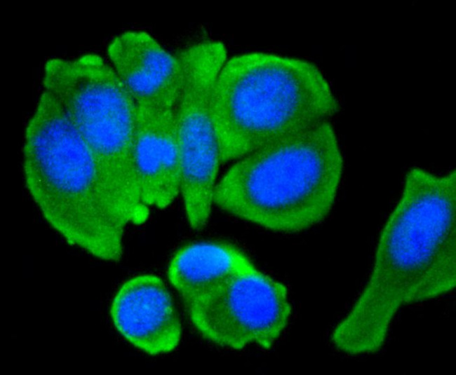 C/EBP beta Antibody in Immunocytochemistry (ICC/IF)