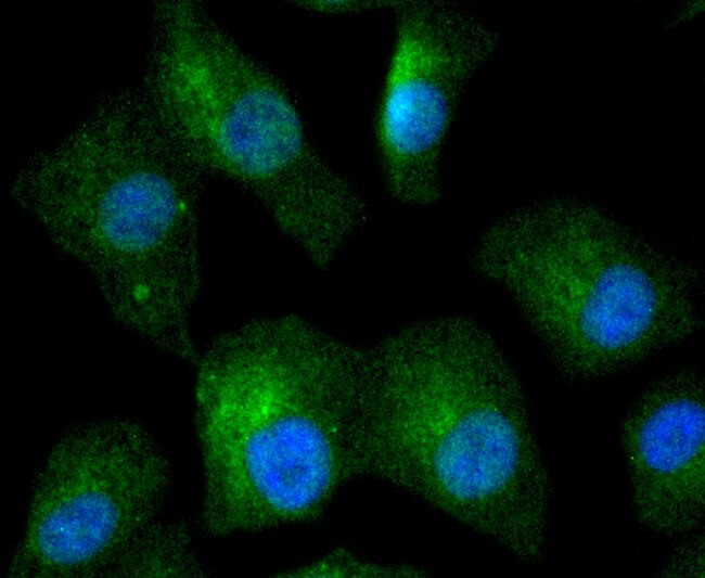 IkB beta Antibody in Immunocytochemistry (ICC/IF)