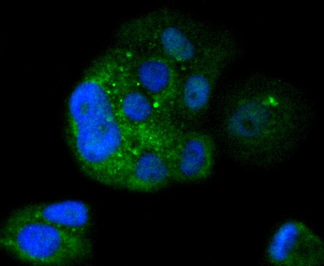 IkB beta Antibody in Immunocytochemistry (ICC/IF)