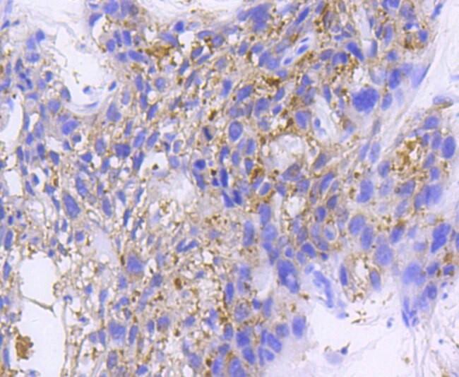 IkB beta Antibody in Immunohistochemistry (Paraffin) (IHC (P))