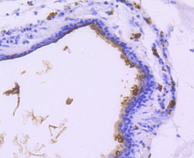 MUC1 Antibody in Immunohistochemistry (Paraffin) (IHC (P))