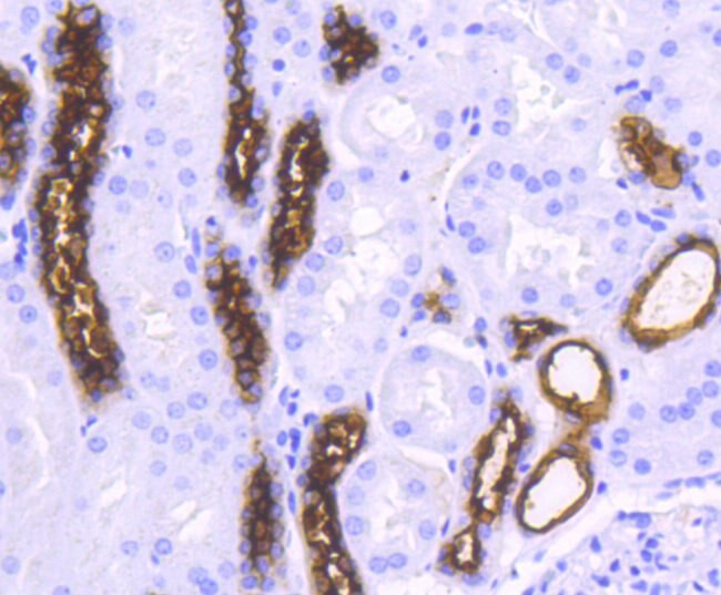 MUC1 Antibody in Immunohistochemistry (Paraffin) (IHC (P))