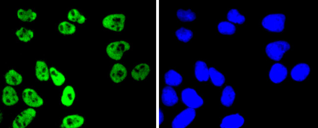 Phospho-MSK1 (Ser376) Antibody in Immunocytochemistry (ICC/IF)