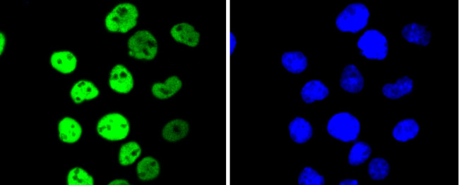 Phospho-MSK1 (Ser376) Antibody in Immunocytochemistry (ICC/IF)