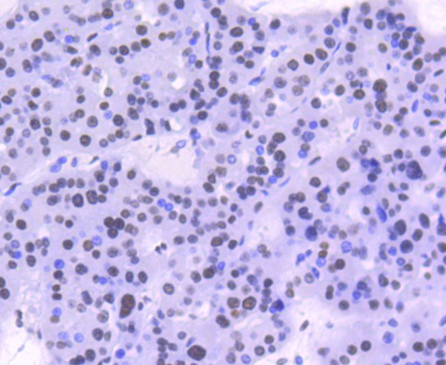 Phospho-STAT1 (Ser727) Antibody in Immunohistochemistry (Paraffin) (IHC (P))