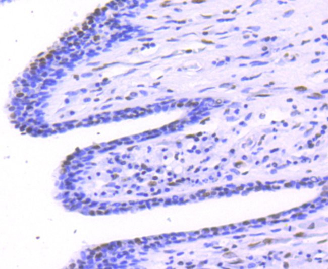 Phospho-STAT1 (Ser727) Antibody in Immunohistochemistry (Paraffin) (IHC (P))