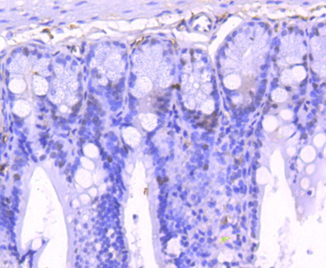 Phospho-STAT1 (Ser727) Antibody in Immunohistochemistry (Paraffin) (IHC (P))