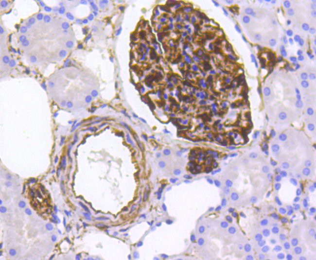 Nestin Antibody in Immunohistochemistry (Paraffin) (IHC (P))