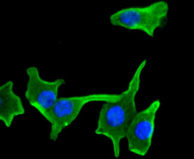 IKK alpha/beta Antibody in Immunocytochemistry (ICC/IF)