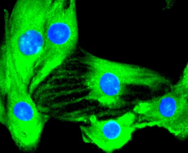 IKK alpha/beta Antibody in Immunocytochemistry (ICC/IF)