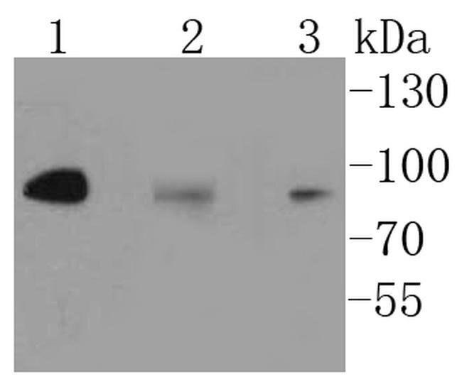 IKK alpha/beta Antibody in Western Blot (WB)