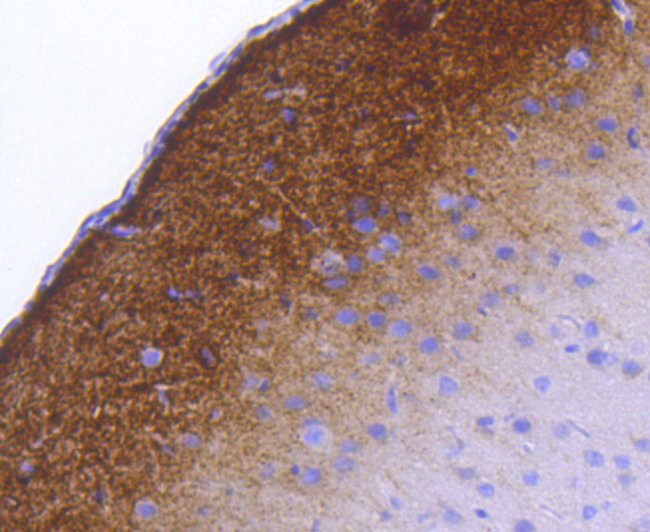 Phospho-Synapsin 1 (Ser9) Antibody in Immunohistochemistry (Paraffin) (IHC (P))