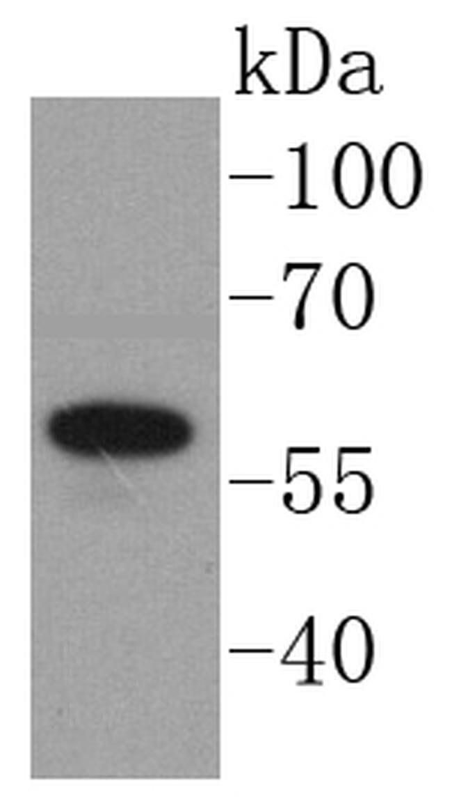 Angiopoietin 1 Antibody in Western Blot (WB)