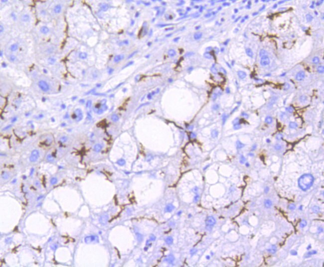 P-Glycoprotein Antibody in Immunohistochemistry (Paraffin) (IHC (P))