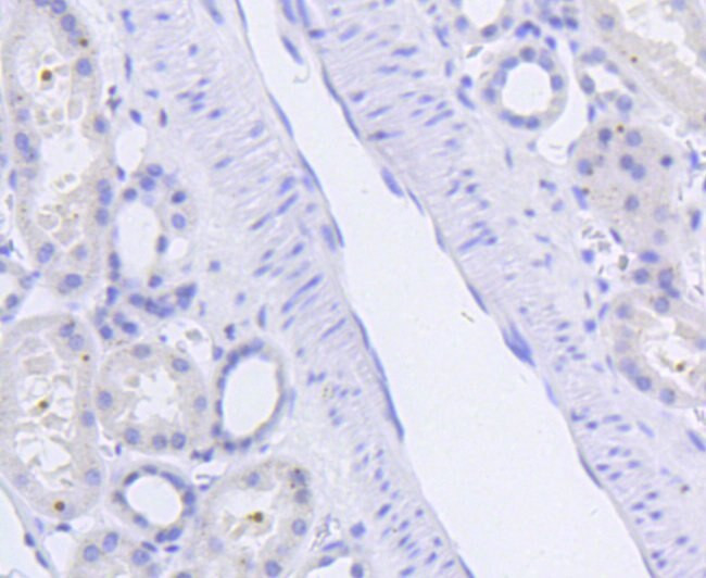 Phospho-SIRT1 (Ser47) Antibody in Immunohistochemistry (Paraffin) (IHC (P))