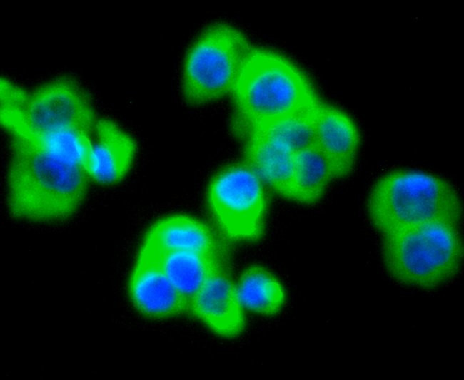 MMP11 Antibody in Immunocytochemistry (ICC/IF)