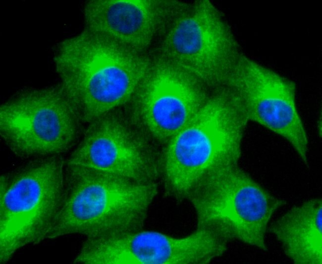 MMP11 Antibody in Immunocytochemistry (ICC/IF)