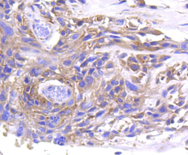 MMP11 Antibody in Immunohistochemistry (Paraffin) (IHC (P))