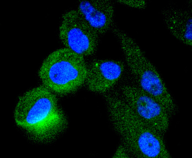 TACC3 Antibody in Immunocytochemistry (ICC/IF)