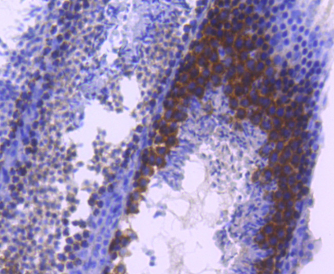 TACC3 Antibody in Immunohistochemistry (Paraffin) (IHC (P))