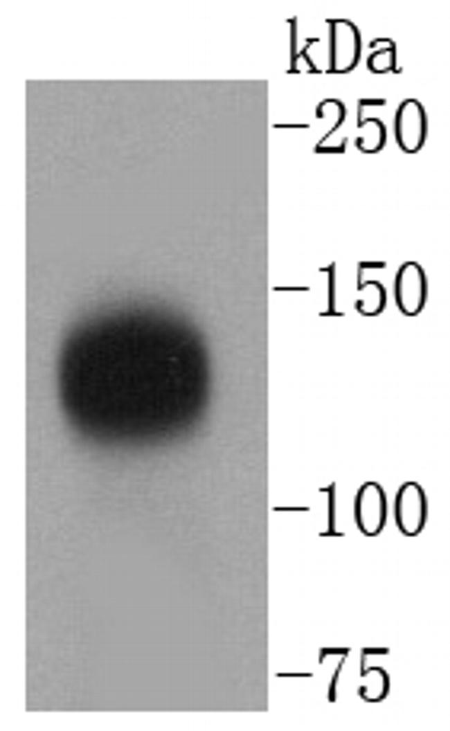 TACC3 Antibody in Western Blot (WB)