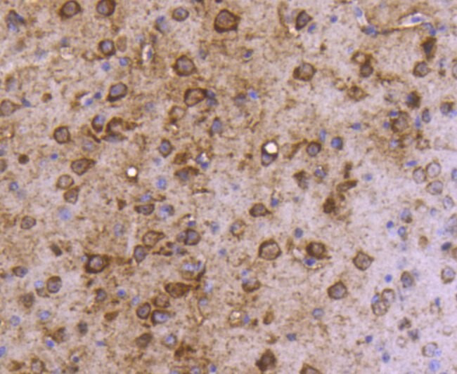LC3A Antibody in Immunohistochemistry (Paraffin) (IHC (P))