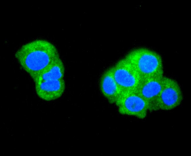 ATG5 Antibody in Immunocytochemistry (ICC/IF)