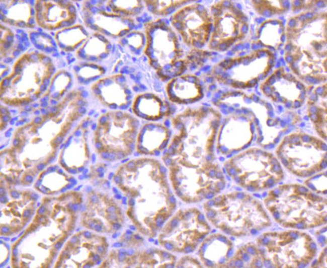 TNFAIP3 Antibody in Immunohistochemistry (Paraffin) (IHC (P))