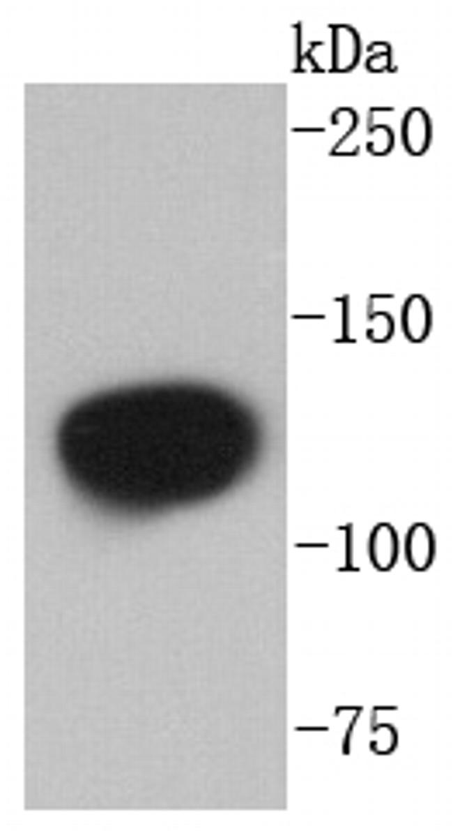 NEDD4L Antibody in Western Blot (WB)