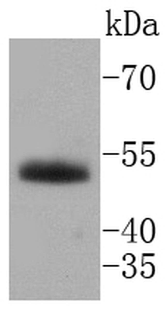 HNF4A Antibody in Western Blot (WB)