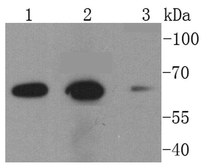 NOX2 Antibody in Western Blot (WB)