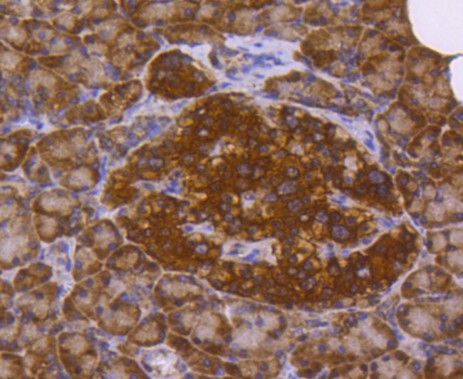 DJ-1 Antibody in Immunohistochemistry (Paraffin) (IHC (P))