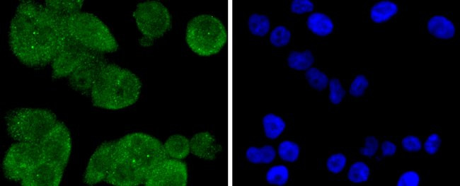 PP2A alpha/beta Antibody in Immunocytochemistry (ICC/IF)