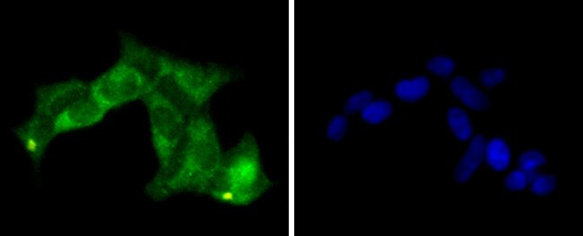 PP2A alpha/beta Antibody in Immunocytochemistry (ICC/IF)