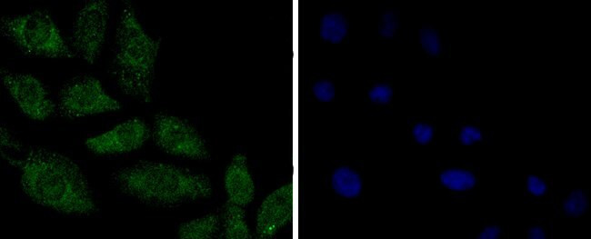 PP2A alpha/beta Antibody in Immunocytochemistry (ICC/IF)