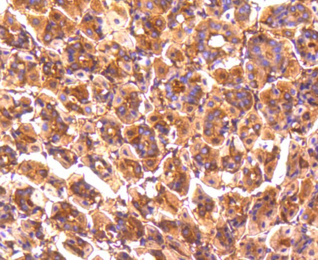 PP2A alpha/beta Antibody in Immunohistochemistry (Paraffin) (IHC (P))